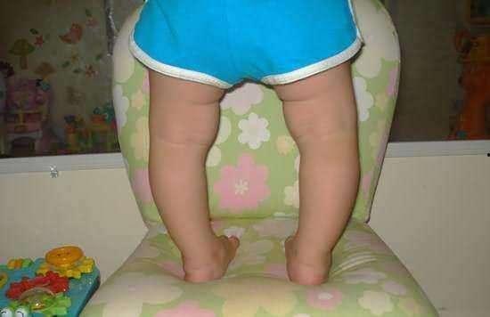 2岁腿图片,2岁宝宝可爱腿姿萌动瞬间